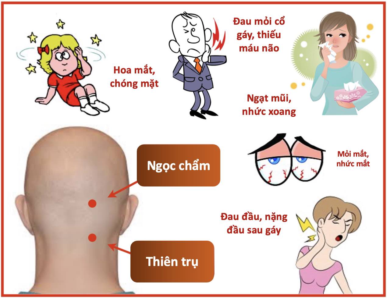 bannẻ